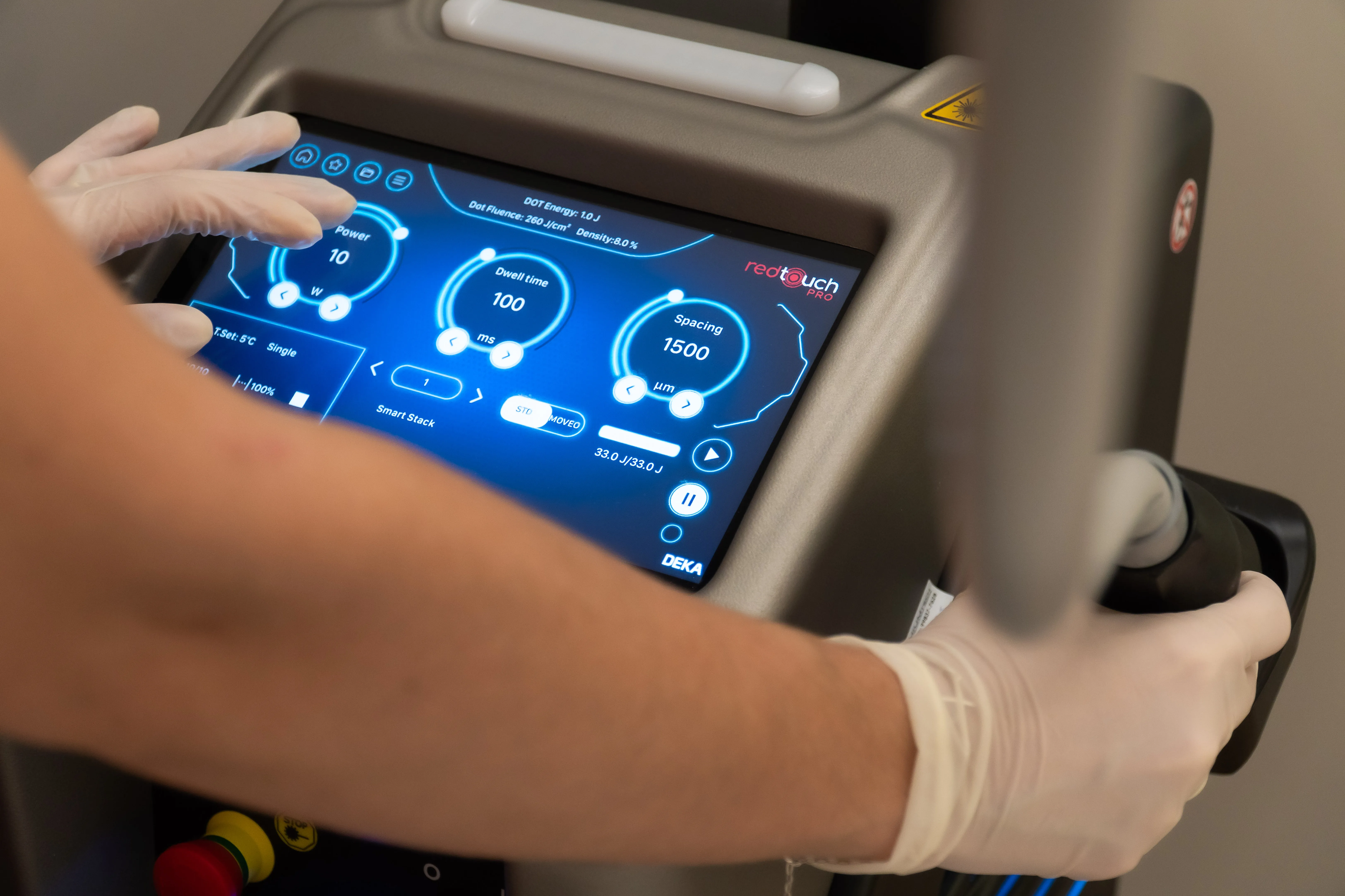 Tecnologia Red Touch - Laser regenerativo para estímulo profundo de colágeno e rejuvenescimento da pele.